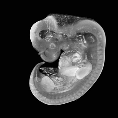 CS15 3-D model — HDBR Atlas